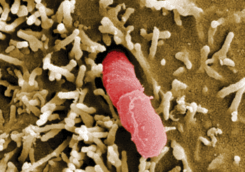 Image: Scanning electron micrograph of Yersinia pseudotuberculosis (Photo courtesy of Helmholtz Centre for Infection Research).